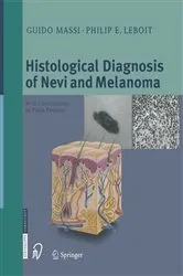 Book cover of Histological Diagnosis of Nevi and Melanoma by Guido Massi