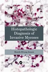 Book cover of Histopathologic Diagnosis of Invasive Mycoses by Henrik Elvang Jensen
