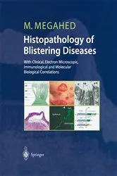 Book cover of Histopathology of Blistering Diseases by Mosaad Megahed