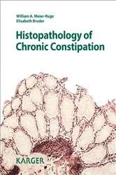 Book cover of Histopathology of Chronic Constipation (2nd ed.) by Unknown