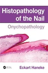 Book cover of Histopathology of the Nail by Eckart Haneke