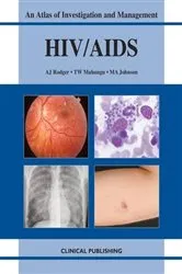 Book cover of HIV/AIDS by A.J. Rodger