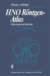 Book cover of HNO RÃ¶ntgen-Atlas by Tilman Brusis