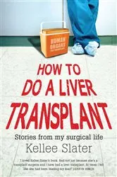 Book cover of How to Do a Liver Transplant by Kellee Slater