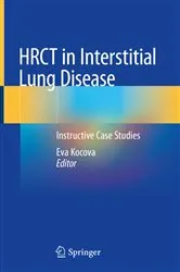 Book cover of HRCT in Interstitial Lung Disease by Eva Kocova