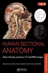 Book cover of Human Sectional Anatomy (4th ed.) by Adrian K. Dixon