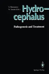 Book cover of Hydrocephalus by Satoshi Matsumoto