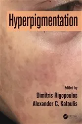 Book cover of Hyperpigmentation by Dimitris Rigopoulos