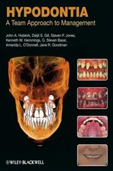 Book cover of Hypodontia by John A. Hobkirk