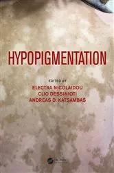 Book cover of Hypopigmentation by Electra Nicolaidou