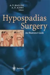 Book cover of Hypospadias Surgery by Unknown