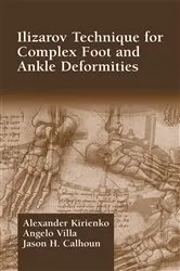 Book cover of Ilizarov Technique for Complex Foot and Ankle Deformities by Unknown