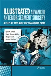 Book cover of Illustrated Advanced Anterior Segment Surgery by Iqbal Ahmed
