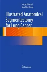 Book cover of Illustrated Anatomical Segmentectomy for Lung Cancer by Hiroaki Nomori