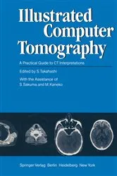 Book cover of Illustrated Computer Tomography by S. Takahashi