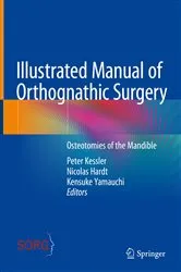 Book cover of Illustrated Manual of Orthognathic Surgery by Peter Kessler