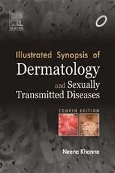 Book cover of Illustrated Synopsis of Dermatology & Sexually Transmitted Diseases - E-book (4th ed.) by Neena Khanna