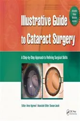 Book cover of Illustrative Guide to Cataract Surgery by Amar Agarwal