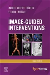 Book cover of Image-Guided Interventions E-Book (3rd ed.) by Thomson MD, FRANZCR, Kenneth R.