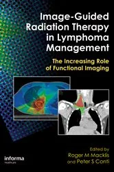Book cover of Image-Guided Radiation Therapy in Lymphoma Management by Roger M. Macklis
