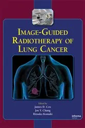 Book cover of Image-Guided Radiotherapy of Lung Cancer by James D. Cox