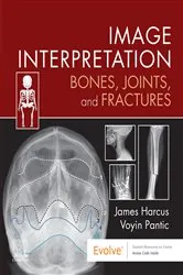 Book cover of Image Interpretation: Bones, Joints, and Fractures - E-Book by James Harcus