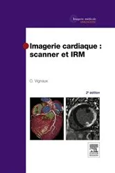 Book cover of Imagerie cardiaque : scanner et IRM (2nd ed.) by Olivier Vignaux