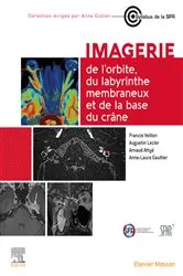 Book cover of Imagerie de l'orbite, du labyrinthe membraneux et de la base du crâne by Francis Veillon