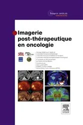 Book cover of Imagerie post-thérapeutique en oncologie by Société Française de Radiologie