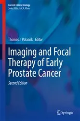 Book cover of Imaging and Focal Therapy of Early Prostate Cancer (2nd ed.) by Thomas J. Polascik