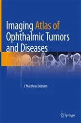 Book cover of Imaging Atlas of Ophthalmic Tumors and Diseases by J. Matthew Debnam