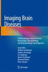 Book cover of Imaging Brain Diseases by Serge Weis