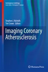 Book cover of Imaging Coronary Atherosclerosis by Stephen J. Nicholls
