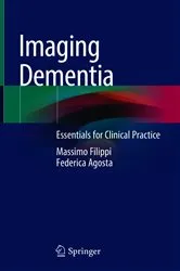 Book cover of Imaging Dementia by Unknown