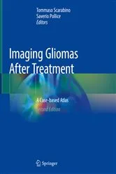 Book cover of Imaging Gliomas After Treatment (2nd ed.) by Tommaso Scarabino