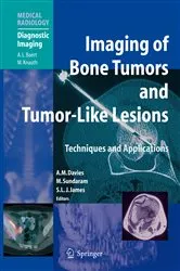 Book cover of Imaging of Bone Tumors and Tumor-Like Lesions by A. Mark Davies