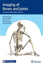 Book cover of Imaging of Bones and Joints by Klaus Bohndorf