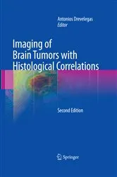 Book cover of Imaging of Brain Tumors with Histological Correlations (2nd ed.) by Antonios Drevelegas