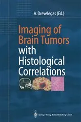 Book cover of Imaging of Brain Tumors with Histological Correlations by Antonios Drevelegas