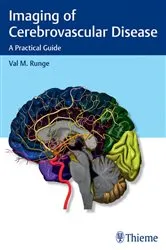 Book cover of Imaging of Cerebrovascular Disease by Val M. Runge