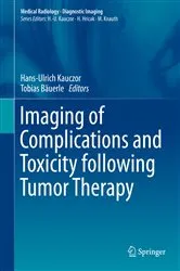 Book cover of Imaging of Complications and Toxicity following Tumor Therapy by Hans-Ulrich Kauczor