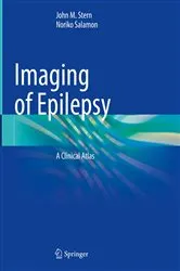 Book cover of Imaging of Epilepsy by John M. Stern