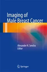 Book cover of Imaging of Male Breast Cancer by Alexander N. Sencha