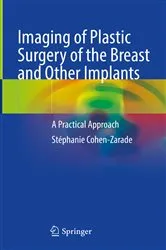 Book cover of Imaging of Plastic Surgery of the Breast and Other Implants by Stéphanie Cohen-Zarade