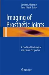 Book cover of Imaging of Prosthetic Joints by Carlina V. Albanese
