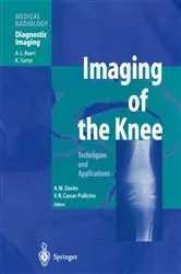 Book cover of Imaging of the Knee by A. Mark Davies