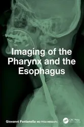 Book cover of Imaging of the Pharynx and the Esophagus by Giovanni Fontanella