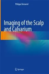 Book cover of Imaging of the Scalp and Calvarium by Philippe Demaerel
