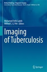Book cover of Imaging of Tuberculosis by Mohamed Fethi Ladeb