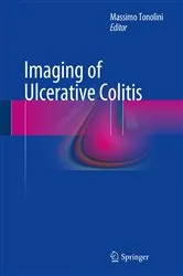 Book cover of Imaging of Ulcerative Colitis by Massimo Tonolini